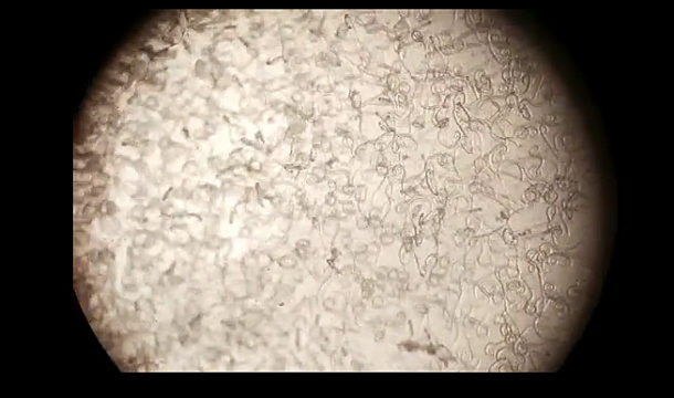Larvas de triquina – captura de video